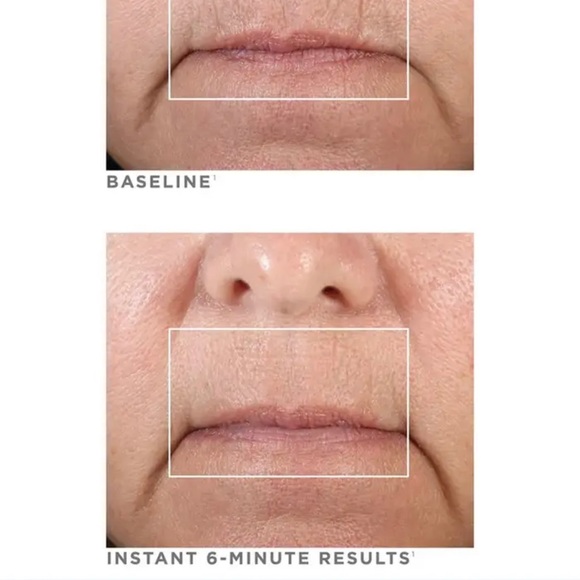 NuFACE FIX Line EYE Lips Face Smoothing Device FDA Cleared w/Starry Eyes masks - Picture 2 of 7